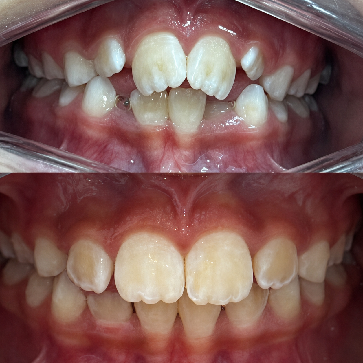 Antes e depois odontológico